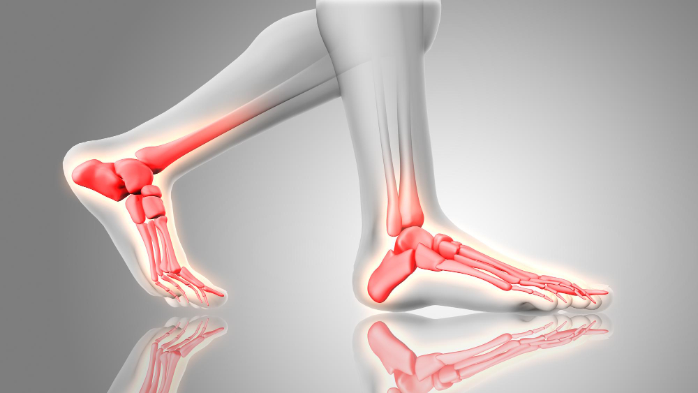 Charcot foot treatment in New York