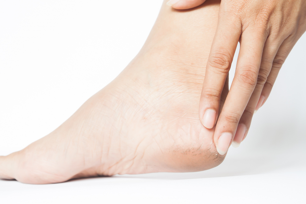 Corns and calluses treatment in New York